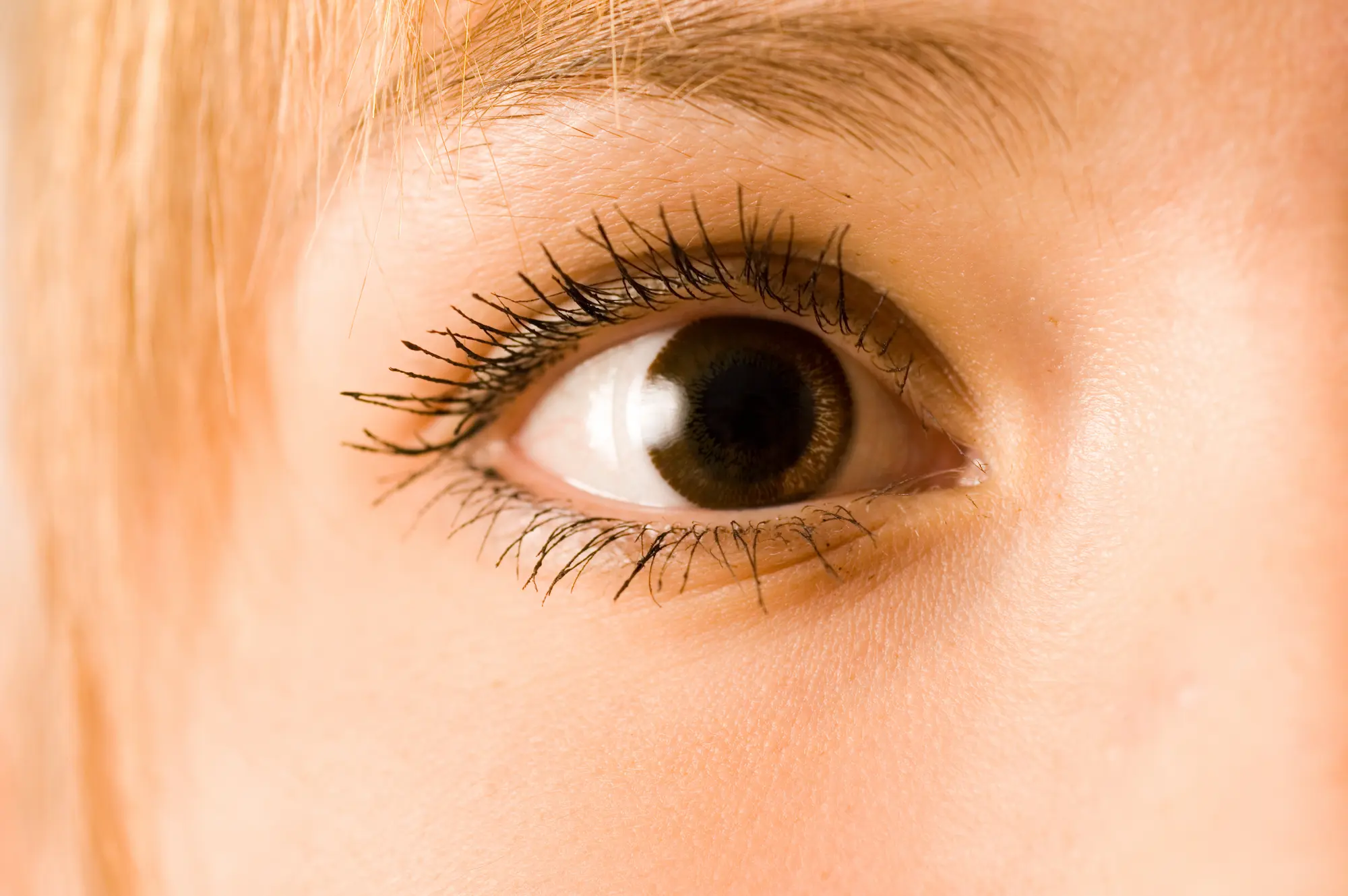 Silmätulehdus: nopea ja edullinen hoito lääkärin etävastaanotolla